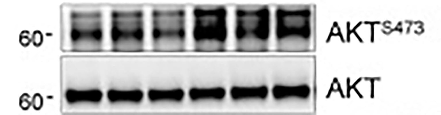 WB - Anti-Akt (N-terminal region) Antibody AN1624
